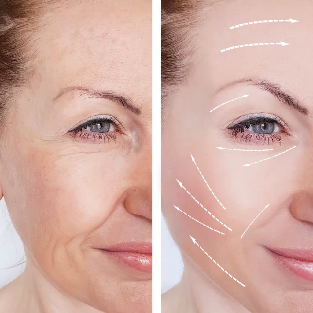 Illustration of upward massage directions on the face for guided facial exercise awareness